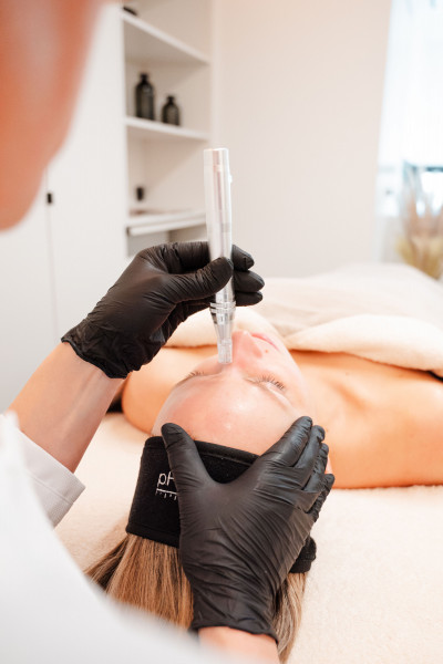 Nanoneedling & Microneedling - PROTONPEN